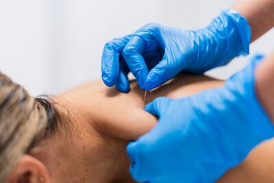 Link to: /pages/acupuncture
