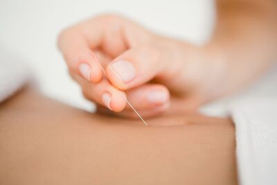 Link to: /pages/acupuncture